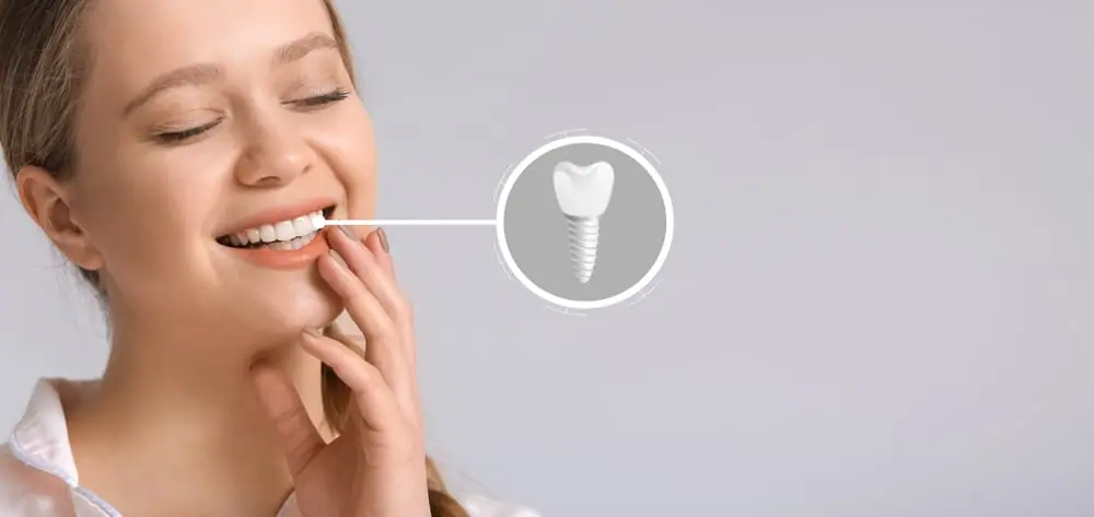 Smiling woman with a dental implant illustration showing tooth replacement